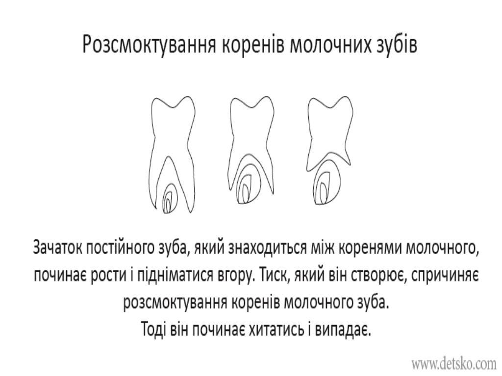 Розсмоктування коренів молочних зубів